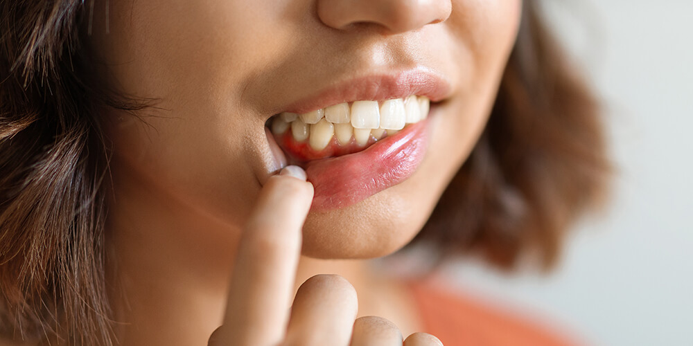 Periodontal Therapy Lloydminster